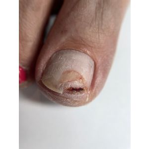 Workshop Perfect Summer Feet 2.0 | Inclusief nagelreparatie